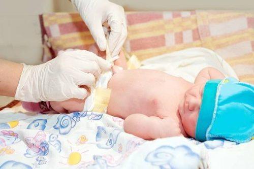 Vệ sinh rốn cho trẻ sơ sinh