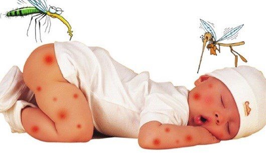 mẹo trị sẹo muỗi đốt cho trẻ