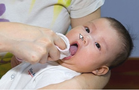 xử lý khi trẻ sơ sinh bị trắng lưỡi