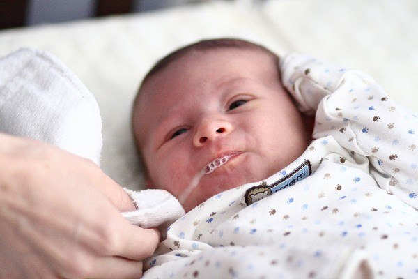 Trào ngược dạ dày thực quản