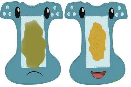 Phân có mùi chua ở trẻ sơ sinh phải làm sao? Phân có mùi chua ở trẻ sơ sinh